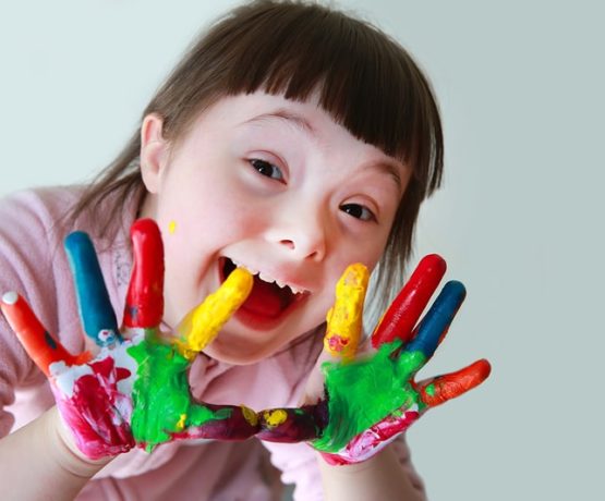 Saiba mais sobre a Síndrome de Down Saiba mais sobre a Síndrome de Down