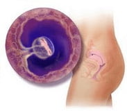 5semana