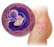 6semana