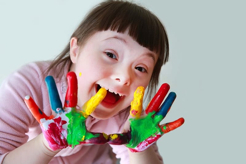 saiba-mais-sobre-a-sindrome-de-down
